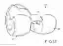 Fig. 10 - Tibial bearing component for a knee prosthesis with improved articular characteristics