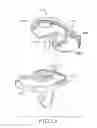 Fig. 11 - Tibial bearing component for a knee prosthesis with improved articular characteristics