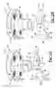Fig. 11 - Glenoid implant
