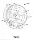 Fig. 12 - Glenoid implant