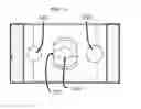 Fig. 07 - INTERBODY SPACER SYSTEM