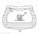 Fig. 08 - INTERBODY SPACER SYSTEM