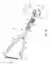 Fig. 47 - Expandable vertebral body replacement device, system, and methods