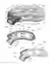 Fig. 05 - Articulating expandable intervertebral implant