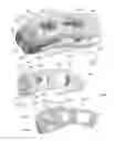 Fig. 06 - Articulating expandable intervertebral implant