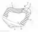 Fig. 01 - Collapsible two-piece olif implant