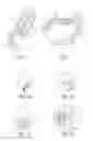 Fig. 02 - Collapsible two-piece olif implant