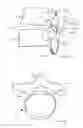 Fig. 02 - Instrument set and method for inserting a cage into the intervertebral disk space between two vertebral bodies