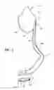 Fig. 02 - BASE PLATE AND BLADE DESIGN FOR A LEG PROSTHETIC