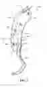 Fig. 04 - SUIT DESIGN FOR A LEG PROSTHETIC