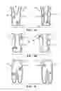 Fig. 05 - SUIT DESIGN FOR A LEG PROSTHETIC