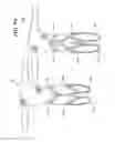 Fig. 06 - SUIT DESIGN FOR A LEG PROSTHETIC