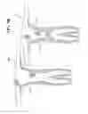 Fig. 07 - SUIT DESIGN FOR A LEG PROSTHETIC