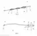 Fig. 03 - Endoluminal drug delivery device