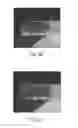 Fig. 03 - Biodegradable endoprostheses and methods of their fabrication