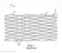 Fig. 02 - INTRAVASCULAR STENT