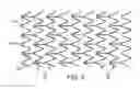 Fig. 04 - INTRAVASCULAR STENT