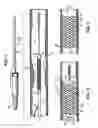 Fig. 02 - LOCKING POLYMER STENTS