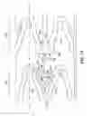 Fig. 09 - LOCKING POLYMER STENTS