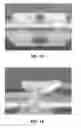 Fig. 11 - LOCKING POLYMER STENTS