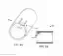 Fig. 05 - Systems and methods for coupling and decoupling a catheter