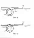 Fig. 09 - Systems and methods for coupling and decoupling a catheter