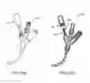 Fig. 23 - Systems and methods for coupling and decoupling a catheter