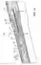 Fig. 04 - Handle for medical device deployment