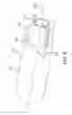 Fig. 06 - Endoprosthesis delivery systems with improved retraction