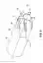 Fig. 07 - Endoprosthesis delivery systems with improved retraction