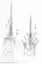 Fig. 06 - Dual capture device for stent graft delivery system and method for capturing a stent graft