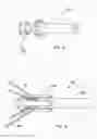 Fig. 10 - Dual capture device for stent graft delivery system and method for capturing a stent graft