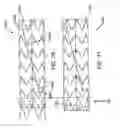 Fig. 26 - Dual capture device for stent graft delivery system and method for capturing a stent graft
