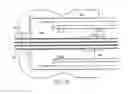 Fig. 44 - Dual capture device for stent graft delivery system and method for capturing a stent graft