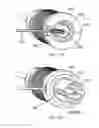 Fig. 49 - Dual capture device for stent graft delivery system and method for capturing a stent graft