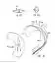Fig. 56 - Dual capture device for stent graft delivery system and method for capturing a stent graft