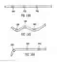 Fig. 60 - Dual capture device for stent graft delivery system and method for capturing a stent graft