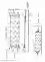 Fig. 70 - Dual capture device for stent graft delivery system and method for capturing a stent graft