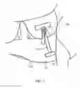 Fig. 08 - Medical Compression Device for Animals