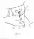 Fig. 09 - Medical Compression Device for Animals
