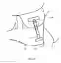Fig. 10 - Medical Compression Device for Animals