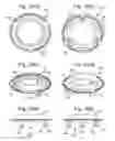 Fig. 15 - IMPLANT ADAPTOR