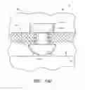 Fig. 40 - Implants with controlled drug delivery features and methods of using same