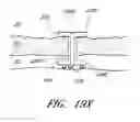 Fig. 49 - Implants with controlled drug delivery features and methods of using same