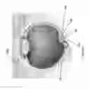 Fig. 58 - Implants with controlled drug delivery features and methods of using same