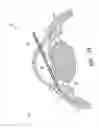 Fig. 63 - Implants with controlled drug delivery features and methods of using same