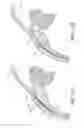 Fig. 67 - Implants with controlled drug delivery features and methods of using same