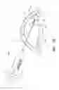 Fig. 68 - Implants with controlled drug delivery features and methods of using same