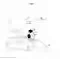 Fig. 05 - Combined laser and phacoemulsification system for eye surgery