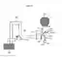 Fig. 11 - Combined laser and phacoemulsification system for eye surgery